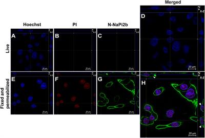 Toward a Topology-Based Therapeutic Design of Membrane Proteins: Validation of NaPi2b Topology in Live Ovarian Cancer Cells